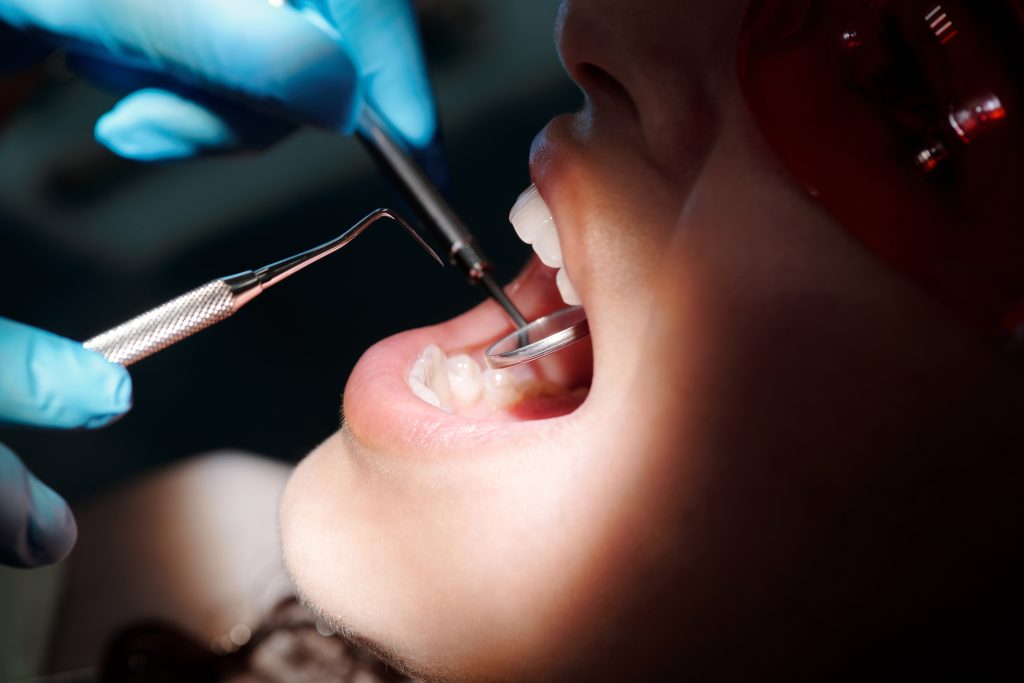 Preventive Dental Care at Aegis Dental Studio in Chembur, Mumbai, India