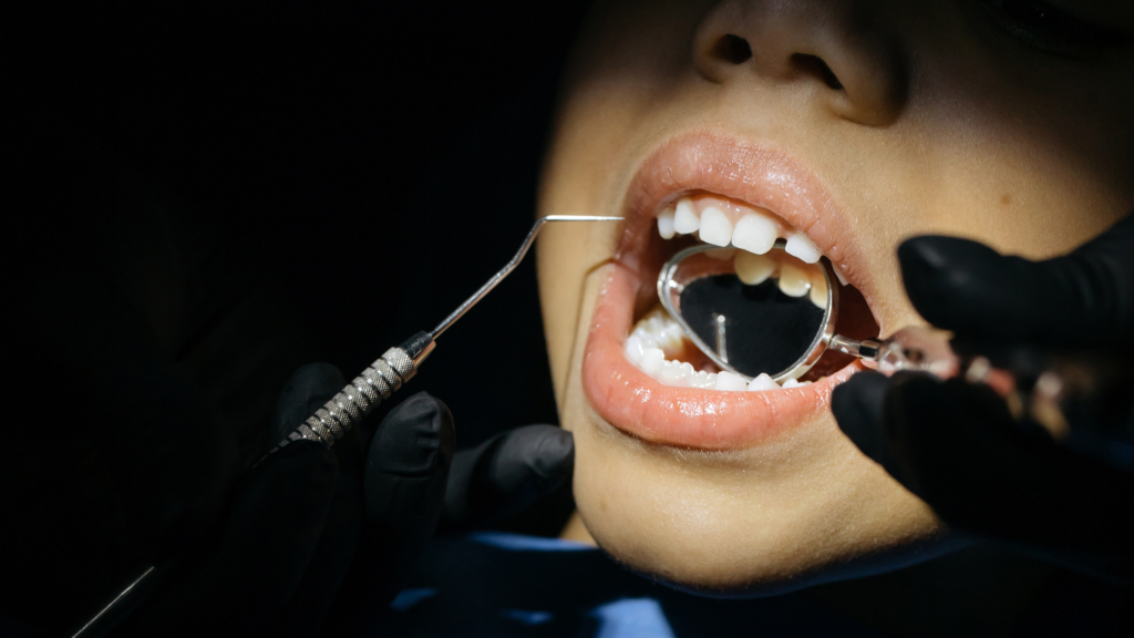 Routine Checkup at Aegis Dental Studio in Chembur, Mumbai, India