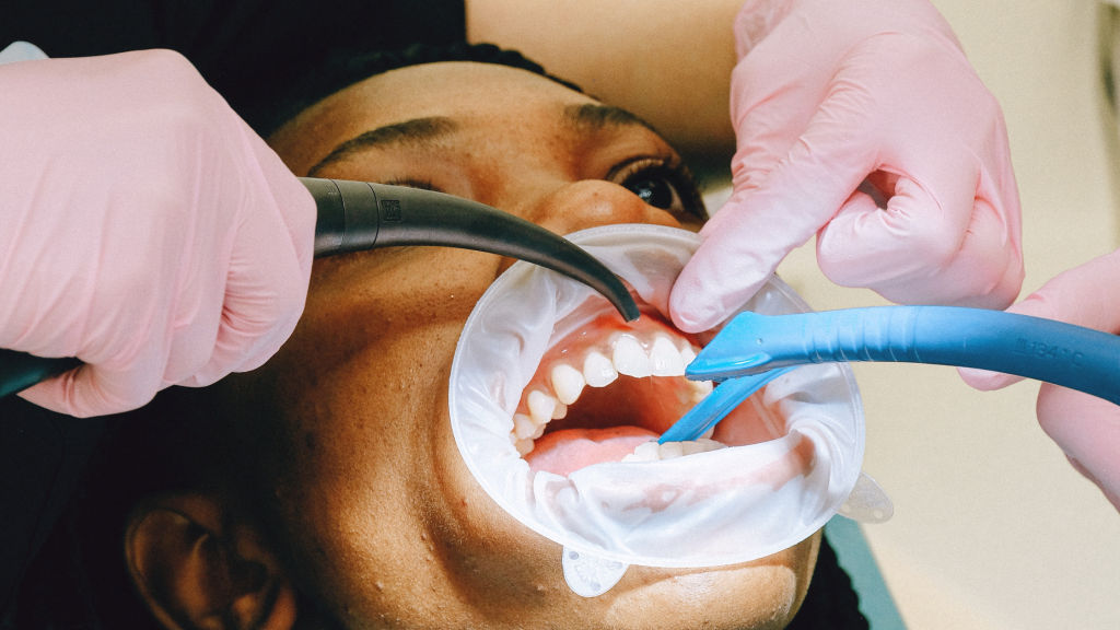 Teeth Cleaning at Aegis Dental Studio in Chembur, Mumbai, India