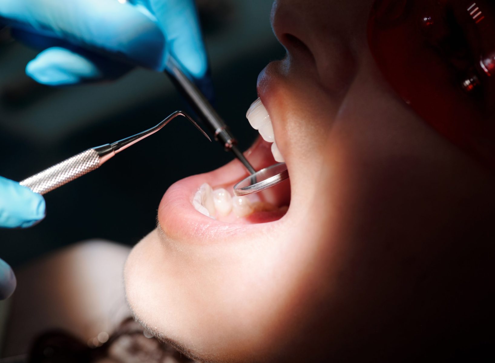 Preventive Dental Care at Aegis Dental Studio in Chembur, Mumbai, India