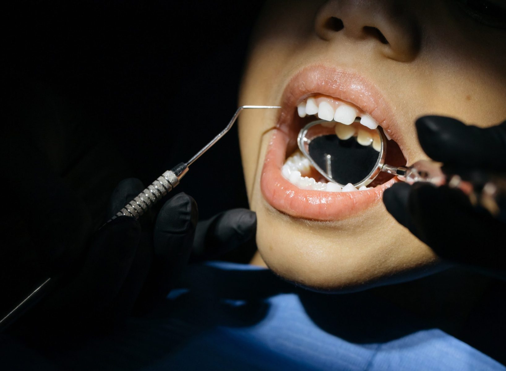 Routine Checkup at Aegis Dental Studio in Chembur, Mumbai, India