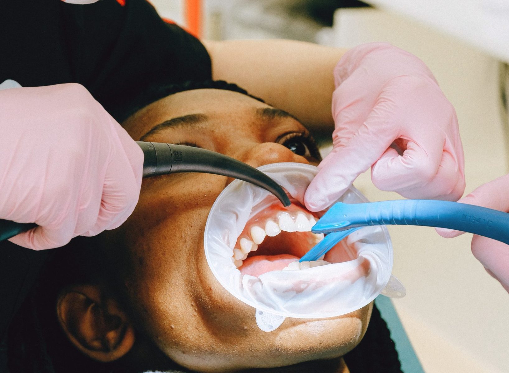 Teeth Cleaning at Aegis Dental Studio in Chembur, Mumbai, India